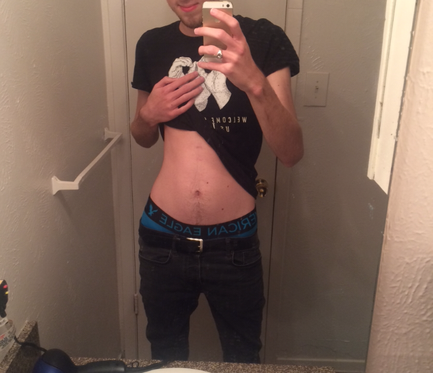 Saggin 1