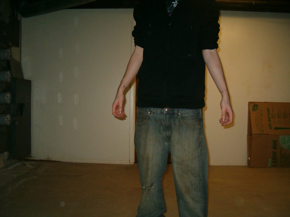 Front Sag