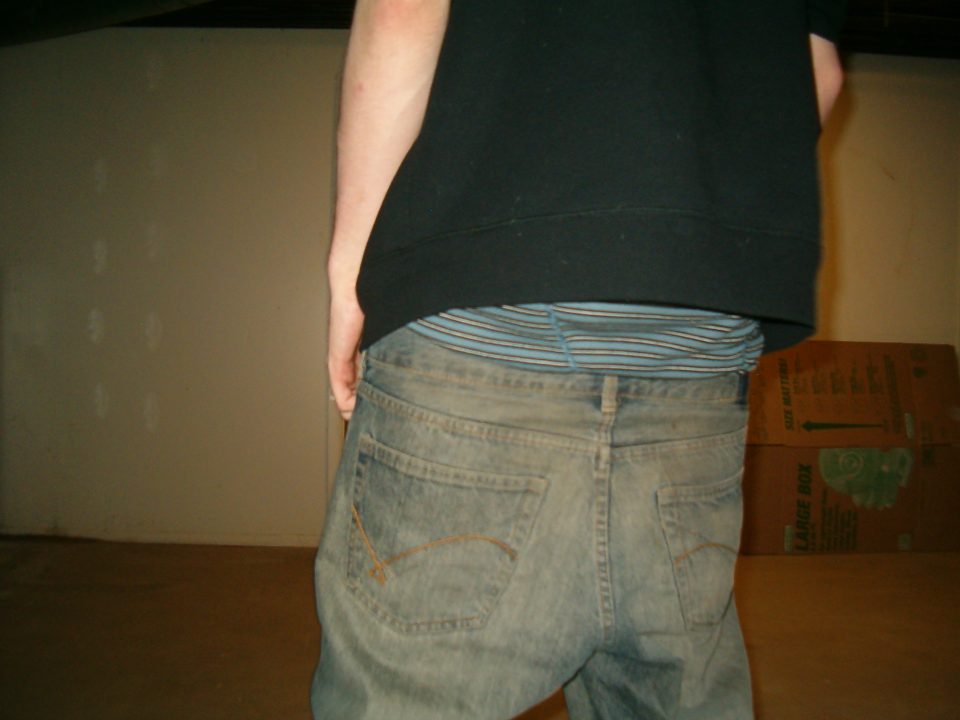 Back sag