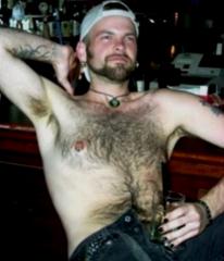 Hairy with black nails