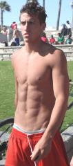 bulging