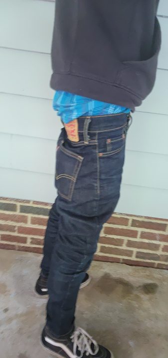 Sagging #1.jpg