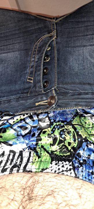 Sagging